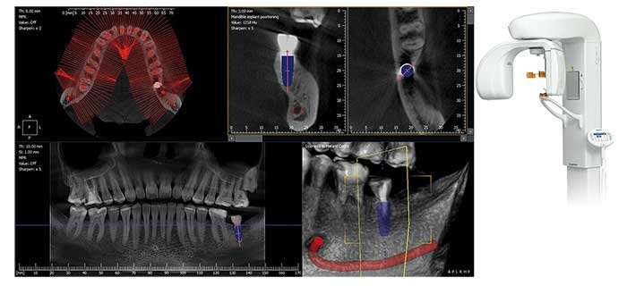 radiografia-3D-clivadent