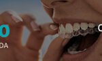 carralero-baner-invisalign-enero-